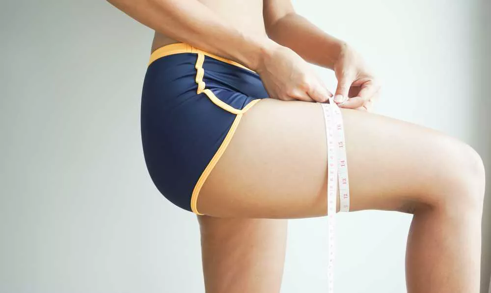 lipedema semptomlari