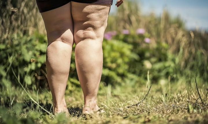 Lipodem nedir?